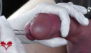 Ideal extraction of sperm directly from the urethra. Close-up of the glass straw sounding.